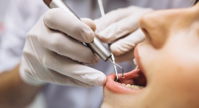 A cirurgia é de baixo risco, cada dente leva cerca de 20 minutos para ser retirado