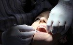 dentista-dente-dor-siso