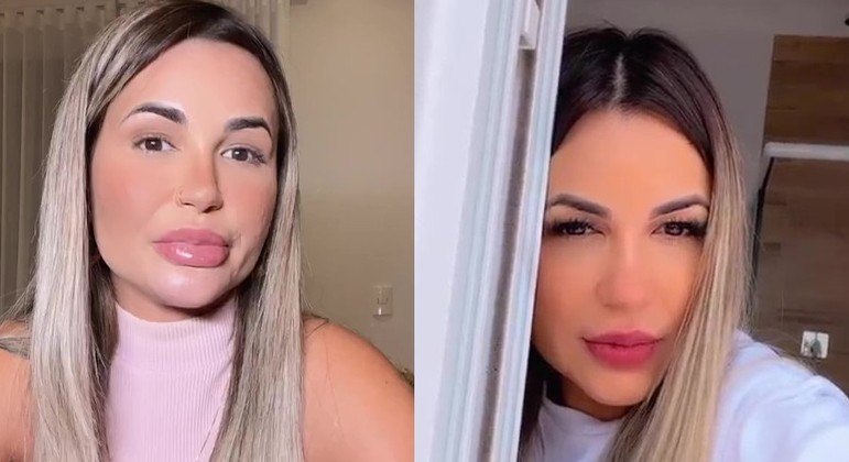 Deolane Bezerra antes e depois de começar o processo de retirada do preenchimento labial