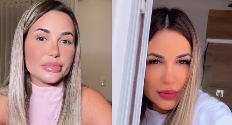 Deolane Bezerra também decidiu retirar o preenchimento labial. Ela mostrou que o processo de reversão já causou mudanças aparentes na boca. 
