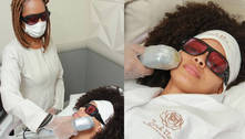 Depilação a laser em pele preta: veja dicas e cuidados necessários para realizar o procedimento