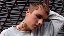 Falso: vacina contra a Covid não causou paralisia facial em Justin Bieber