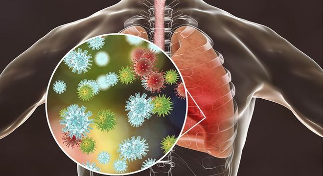 Sars-CoV-2 pode ser encontrado tanto no trato respiratório superior quanto no inferior