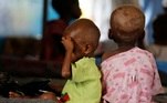 Crianças desnutridas em hospital da República Democrática do Congo