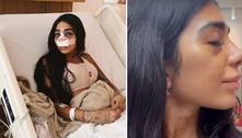Dhiovanna Barbosa, irmã de Gabigol, chora ao ver resultado de rinoplastia: 'Fiquei chocada'