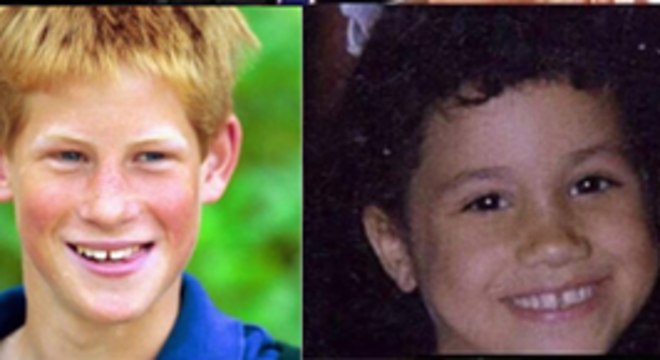 Os dois, quando crianças, exibiam os dentinhos separados 