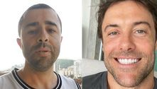 Motorista que atropelou Kayky Brito faz harmonização facial e é criticado; veja o antes e depois