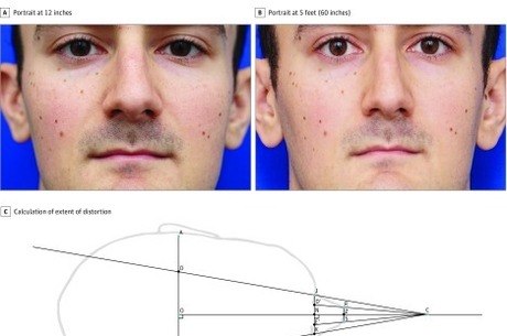 Foto retirada do estudo "Distorção nasal em fotos de curta distância: o efeito selfie"