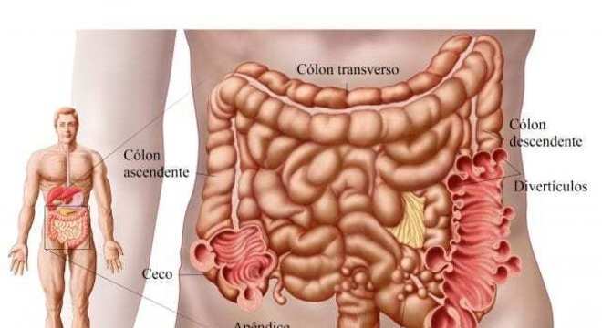 Diverticulite - O que é, quais os sintomas e tratamentos?