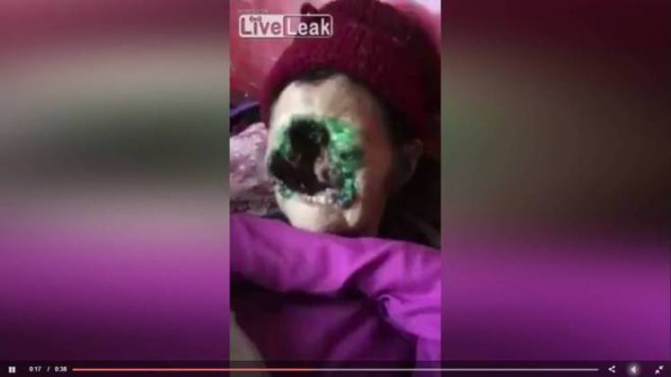 Doenca Misteriosa Mantem Mulher Em Gaiola De Vidro Ha 13 Anos Fotos R7 Hora 7