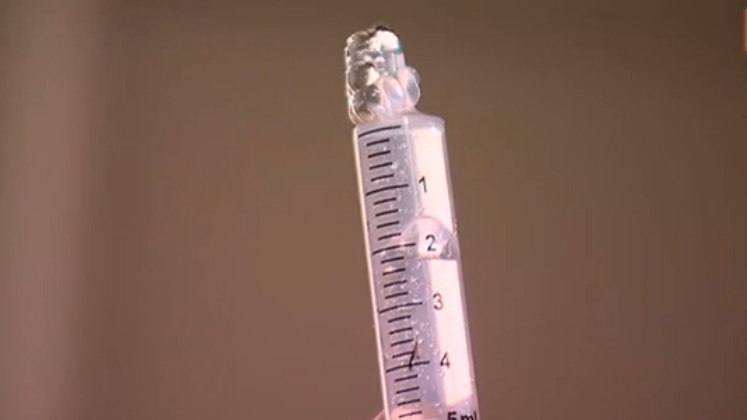 A modelo procurou o médico que havia feito as aplicações, mas diz que ele foi omisso no atendimento e não deu atenção ao caso dela ou a solução necessária. Naquele ano, Ana precisou passar por uma cirurgia, que pôs sua vida em risco, para a retirada da substância 