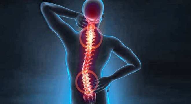 Dor na nuca - doenças relacionadas e como identificar situações graves