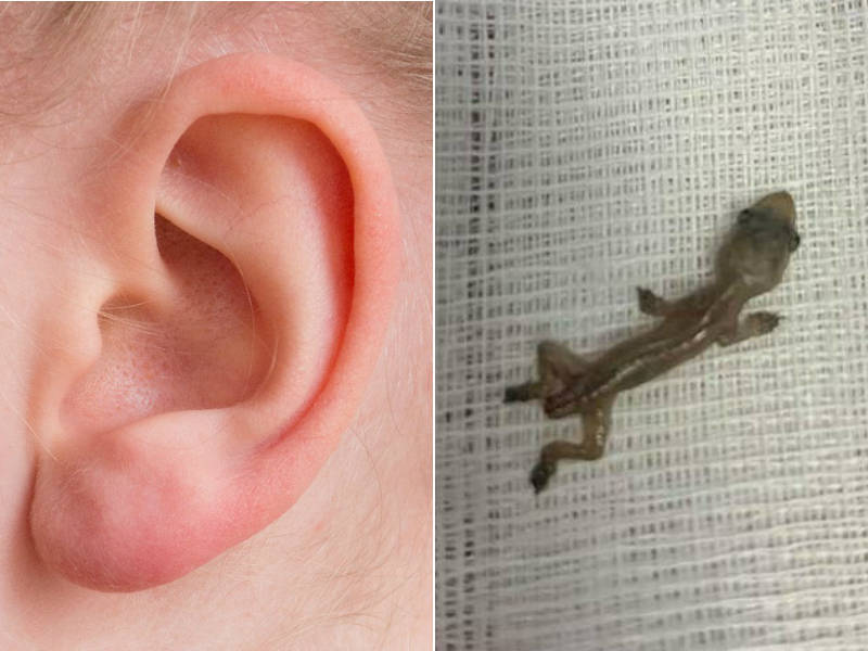 Homem Come Lagartixa Por Causa De Aposta E Enfrenta Destino Chocante Fotos R7 Hora 7