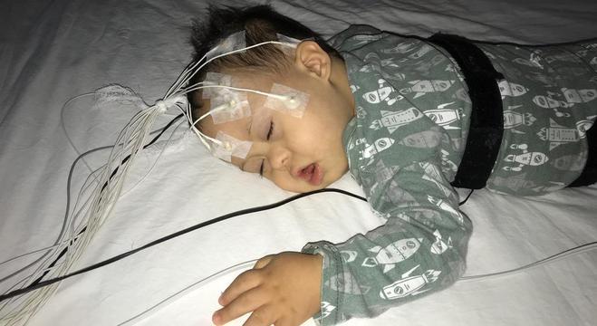 Apneia compromete qualidade do sono das crianças