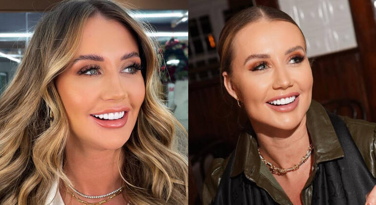 Irmã de Ana Paula Siebert, Duda Siebert também se sentou na cadeira do dentista e se levantou uma nova mulher. Hoje, a influenciadora exibe um sorriso extremamente branco e simétrico