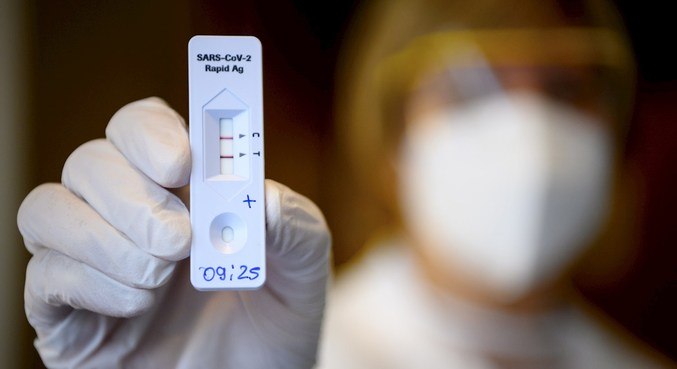 O teste rápido detecta a covid-19 nos primeiros dias da infecção