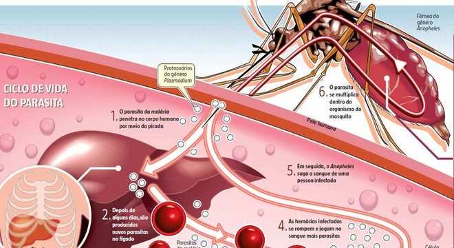 Elefantíase - o que é? Causas, sintomas e tratamento da doença