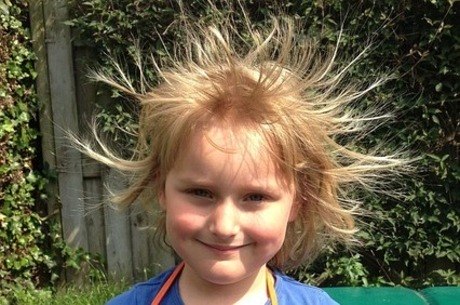 Energia estática também age sobre os cabelos, causando os arrepios 