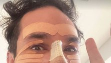 Eliezer aparece sem dente e assusta internautas com rosto cheio de curativos 