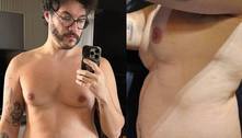 Eliezer revela sofrer de desequilíbrio hormonal que faz as mamas crescerem: 'Incomoda' 