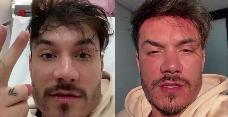 Ainda em 2022, Eli contou que estava fazendo aplicações de laser no rosto e foi a uma clínica de estética para mais uma sessão do tratamento. 