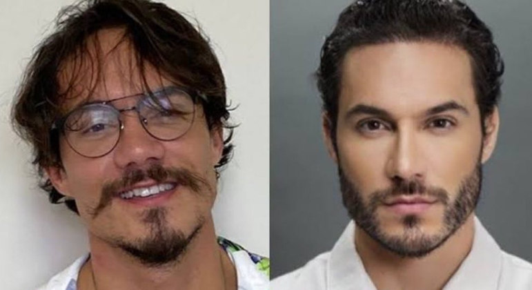 Mas o influenciador não passou só por uma sessão de harmonização. Após a fama, ele deu uma retocada nos procedimentos e surgiu ostentando mais uma versão de si