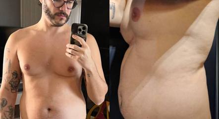 Eliezer mostra barriga antes de dieta