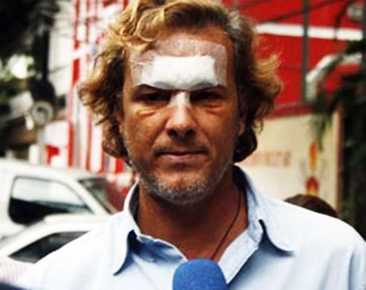 Em 2008, o ator Marcello Novaes foi agredido em uma balada no Rio de Janeiro. Na época, ele gravava uma novela e o seu personagem foi atropelado, para justificar os ferimentos.