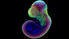 Cientistas desenvolvem embrião de rato em útero artificial