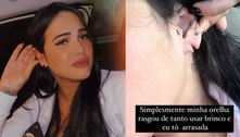 Emily Garcia mostra orelha rasgada após usar brincos: 'Arrasada'