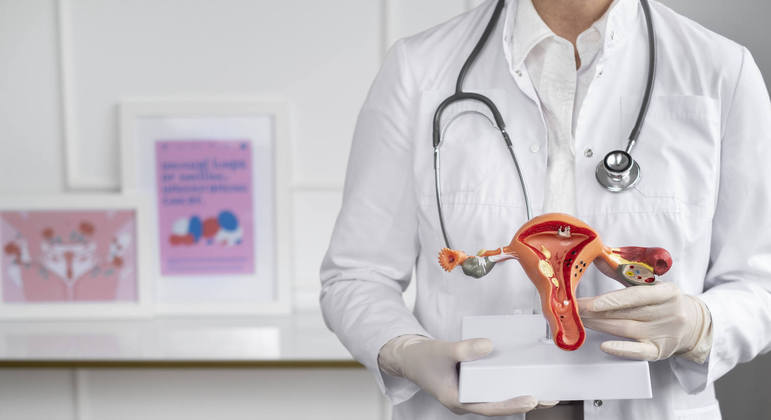 Endometriose é causada por um crescimento anormal do endométrio 