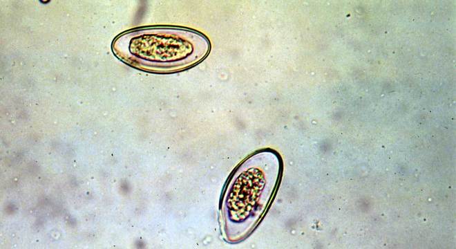 Enterobíase - o que é, causas, tratamento e prevenção