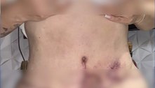 Polícia investiga cirurgiã plástica por negligência