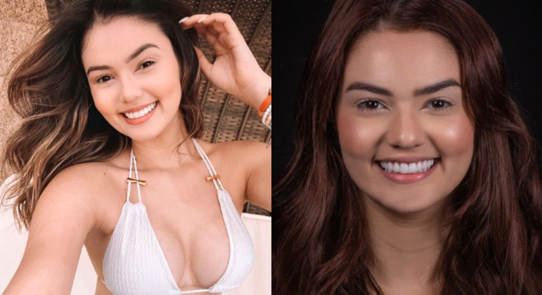 Em maio deste ano, Eslovenia disse nos stories que tinha feito alguns retoques de harmonização facial que incluíram nariz, boca, queixo e maçãs do rosto, além de ter colocado lentes de contato dentais. 'Olha só que lindeza essa transformação. Amando demais o resultado do meu sorriso. Não estou conseguindo parar de olhar para todos os detalhes, que ficaram supernaturais e da forma que sempre sonhei', comemorou