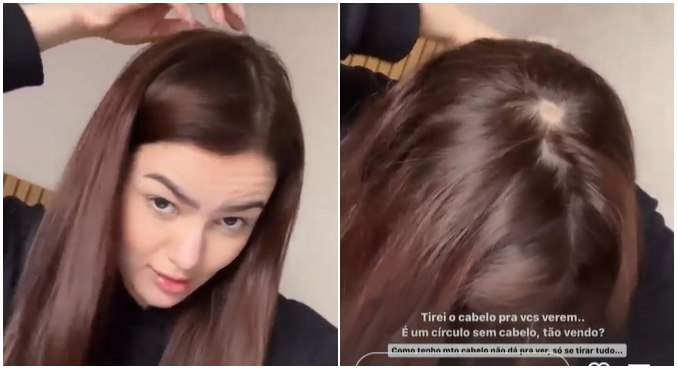 Eslovênia mostrou a região do couro cabeludo sem cabelo aos seguidores