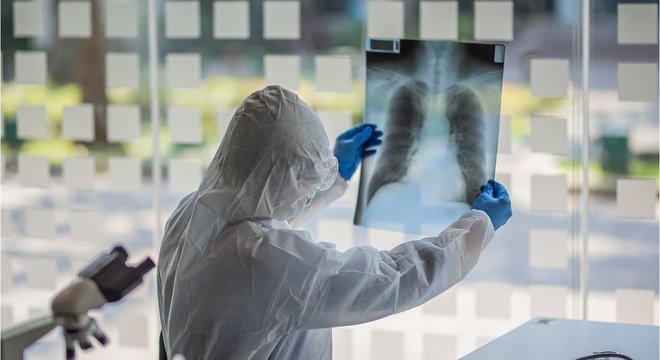 Sintomas de pacientes antes do primeiro caso no Brasil podem ter sido associados a outras doen&ccedil;as, sem que m&eacute;dicos suspeitassem de covid-19, afirmam especialistas