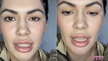 Esposa usa apelido com o marido por não saber dizer o nome dele 