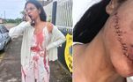 Uma estudante de enfermagem, identificada como Stefani Firmo, teve o rosto cortado enquanto dormia em uma viagem de ônibus de Recife, em Pernambuco, para Salvador, na Bahia. O ataque ocorreu no último fim de semana, mas a empresa de ônibus disponibilizou o vídeo do ataque, compartilhado pela jovem nas redes sociais, somente na segunda-feira (5)