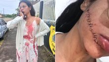 Vídeo mostra ataque à estudante que teve o rosto cortado enquanto dormia em ônibus
