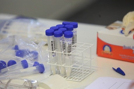 PCR leva alguns dias após infecção para dar positivo