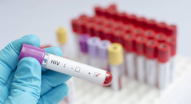 No Brasil, estima-se que 866 mil pessoas vivem com HIV 