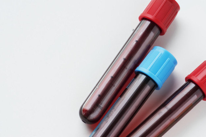 Se o doador mente em algum dos requisitos, apÃ³s o colhimento do sangue Ã© possÃ­vel descobrir? Embora existam exames para a verificaÃ§Ã£o de doenÃ§as transmissÃ­veis, requisitos como tatuagens recÃ©m feitas nÃ£o podem ser descobertas. Odila explica que, por isso, o doador deve assinar um documento na entrevista, alegando que todas as informaÃ§Ãµes passadas sejam verdadeiras