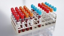 Exame de sangue em fase de testes é capaz de identificar 50 tipos de câncer, sugere estudo
