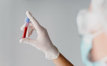 Hemograma completoÉ o mais básico dos exames de sangue. Ele avalia diversas partes e características do sangue, como eritrócitos, leucócitos, plaquetas, hemoglobina e hematócrito. Pode ser parte de um check-up ou diagnóstico de condições médicas. Resultados anormais podem indicar problemas como anemia, distúrbios autoimunes, infecções ou reações medicamentosas. No entanto, variações podem ser influenciadas por fatores como dieta, atividade e ciclo menstrual, e é importante discutir os resultados com um profissional de saúde para obter uma interpretação adequada, segundo o Manual MSD de Diagnóstico e Tratamento