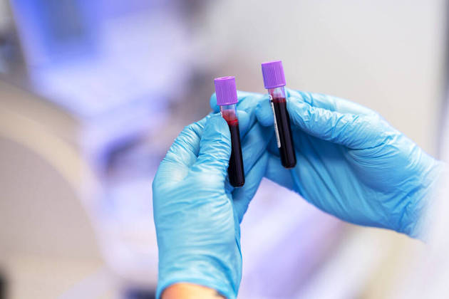 Vitamina DÉ cada vez mais comum que médicos requeiram um exame chamado vitamina D-25 hidroxi, que identifica se os níveis de vitamina D no sangue estão adequados. A deficiência é frequente principalmente em idosos e pode causar problemas ósseos e indisposição, entre outros sintomas