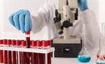 Ácido úricoAlguns indivíduos podem ter de fazer exame para verificar o nível de ácido úrico no sangue. Em taxas elevadas (hiperuricemia), pode sugerir o acúmulo de alguns cristais que causam inflamações em articulações e tecidos. É um exame comum para auxiliar no diagnóstico de gota