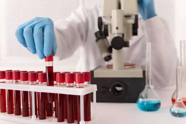 Ácido úricoAlguns indivíduos podem ter de fazer exame para verificar o nível de ácido úrico no sangue. Em taxas elevadas (hiperuricemia), pode sugerir o acúmulo de alguns cristais que causam inflamações em articulações e tecidos. É um exame comum para auxiliar no diagnóstico de gota