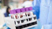 Pandemia causa queda de 27 mi procedimentos de saúde 