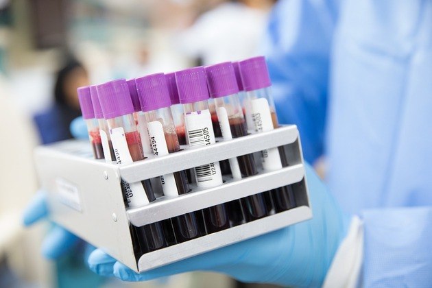 No Brasil, a Sbem (Sociedade Brasileira de Endocrinologia e Metabologia) entende ideais em adultos níveis de vitamina D acima de 20 ng/ml (nanogramas por mililitro) — verificados por meio de exame do sangue. Todavia, para idosos, o indicado é entre 30 ng/ml e 60 ng/ml. O mesmo vale para indivíduos que foram submetidos a uma cirurgia bariátrica, que tenham doença inflamatória intestinal, estejam em terapia antirretroviral ou em tratamento oncológico, entre outras condições