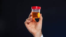 O que significa espuma na urina? Substâncias expelidas no xixi podem indicar problemas de saúde